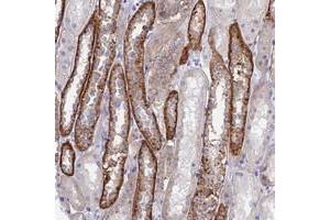 Immunohistochemical staining of human kidney with CHSY3 polyclonal antibody  shows strong cytoplasmic positivity in renal tubules at 1:50-1:200 dilution. (CHSY3 antibody)