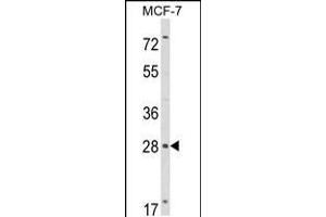 Western blot analysis of RASL11B Antibody in MCF-7 cell line lysates (35ug/lane) (RASL11B antibody  (N-Term))