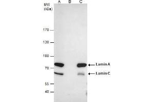 IP Image Lamin A + C antibody immunoprecipitates Lamin A + C protein in IP experiments.