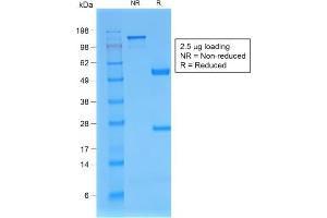 SDS-PAGE (SDS) image for anti-beta-2-Microglobulin (B2M) antibody (ABIN6940416)