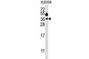 Western Blotting (WB) image for anti-Vesicle-Associated Membrane Protein 7 (VAMP7) antibody (ABIN2997586) (VAMP7 antibody)