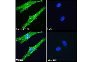 ABIN570824 Immunofluorescence analysis of paraformaldehyde fixed HeLa cells, permeabilized with 0. (SLC12A2 antibody  (Internal Region))