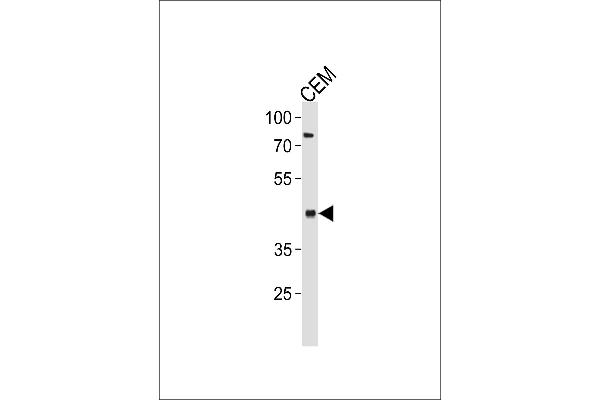 FADS2 Antikörper  (AA 96-122)
