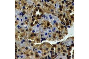 Immunohistochemical analysis of WBSCR22 staining in human kidney formalin fixed paraffin embedded tissue section. (WBSCR22 antibody)