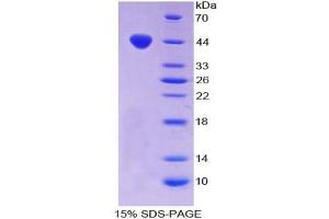 SDS-PAGE analysis of Mouse Chemerin Protein. (Chemerin Protein)