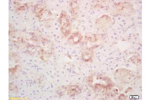 Formalin-fixed and paraffin embedded rat thyroid labeled with Rabbit Anti PLRP1/PNLIPRP1 Polyclonal Antibody, Unconjugated (ABIN718826) at 1:200 followed by conjugation to the secondary antibody and DAB staining (PNLIPRP1 antibody  (AA 375-467))