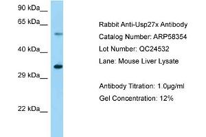 Western Blotting (WB) image for anti-Ubiquitin Specific Peptidase 27, X-Linked (USP27X) (Middle Region) antibody (ABIN2787648) (USP27X antibody  (Middle Region))