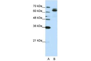 FXR1 antibody used at 0. (FXR1 antibody  (C-Term))