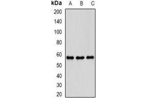 Western blot analysis of PDE1B expression in THP1 (A), mouse brain (B), mouse spleen (C) whole cell lysates. (PDE1B antibody)