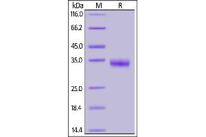 SARS-CoV-2 S protein RBD (R408I), His Tag on SDS-PAGE under reducing (R) condition. (SARS-CoV-2 Spike S1 Protein (R408I, RBD) (His tag))