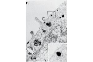Electron microscopic image of internalized EGF-R/antibody-complexes in A431 cells. (EGFR antibody  (Extracellular, non Ligand Binding Domain))