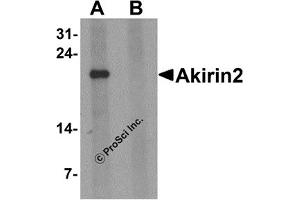 Western Blotting (WB) image for anti-Akirin 2 (AKIRIN2) (Middle Region 1) antibody (ABIN1031185) (AKIRIN2 antibody  (Middle Region 1))