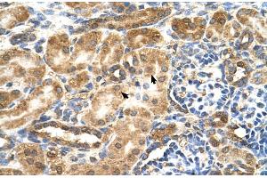Human kidney (GCNT3 antibody  (C-Term))