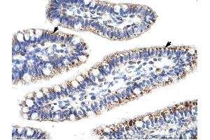 KLHL13 antibody was used for immunohistochemistry at a concentration of 4-8 ug/ml to stain Epithelial cells of intestinal villus (arrows) in Human Intestine.