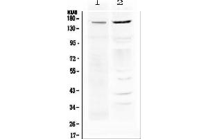 Western Blotting (WB) image for anti-ATP-Binding Cassette, Sub-Family B (MDR/TAP), Member 1 (ABCB1) antibody (ABIN5693064) (ABCB1 antibody)