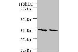 Western blot All lanes: SNX20 antibody at 2 μg/mL Lane 1: Mouse spleen tissue Lane 2: Mouse skeletal muscle tissue Secondary Goat polyclonal to rabbit IgG at 1/10000 dilution Predicted band size: 37, 18, 15, 12 kDa Observed band size: 37 kDa (Sorting Nexin 2 antibody  (AA 1-102))