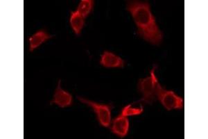 ABIN6277399 staining HeLa by IF/ICC.
