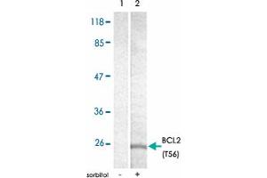 Western blot analysis of extracts from MDA-MB-435 cells, treated with sorbtiol (0. (Bcl-2 antibody  (pThr56))