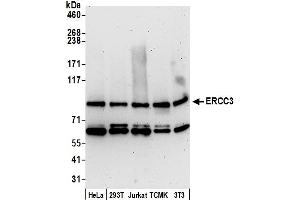 anti-DNA Repair Protein Complementing XP-B Cells (ERCC3) (AA 732-782) antibody