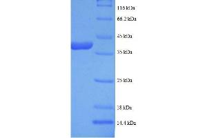 LDHB Protein (AA 2-334, full length) (His tag)