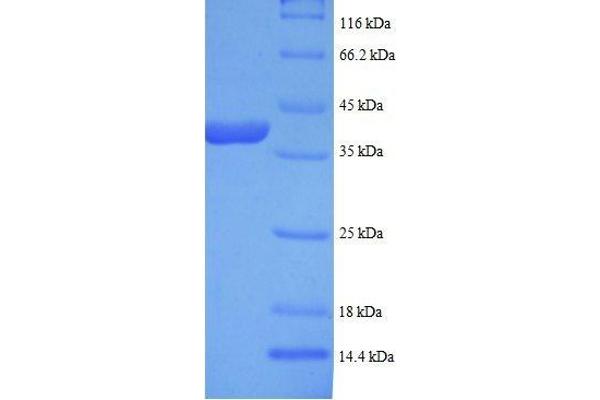 LDHB Protein (AA 2-334, full length) (His tag)