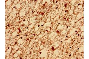 Immunohistochemistry analysis of human brain tissue using ABIN7151479 at dilution of 1:100 (ELAVL2 antibody  (AA 4-356))