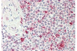 Rabbit Anti-PSAT1 antibody  Formalin Fixed Paraffin Embedded Tissue: Human Spleen Primary antibody Concentration: 1:100 Secondary Antibody: Donkey anti-Rabbit-Cy3 Secondary Antibody Concentration: 1:200 Magnification: 20x Exposure Time: 0. (PSAT1 antibody  (N-Term))