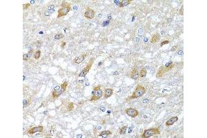 Immunohistochemistry of paraffin-embedded Rat brain using HSPA6 Polyclonal Antibody at dilution of 1:100 (40x lens). (HSPA6 antibody)