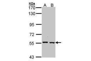 Image no. 1 for anti-Catalase (CAT) (AA 89-311) antibody (ABIN467582) (Catalase antibody  (AA 89-311))