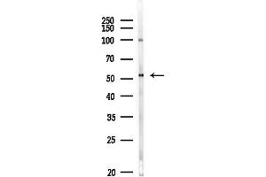 Western blot analysis of lysates from MDA-MB-231 cells(heat-shock,45 min treatment), using PDE1A Antibody at 1/1000 dilution.