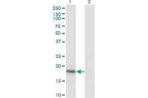 Western Blot analysis of KISS1 expression in transfected 293T cell line by KISS1 monoclonal antibody (M05), clone 1F7. (KISS1 antibody  (AA 46-145))