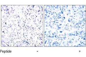 Image no. 1 for anti-Retinoblastoma 1 (RB1) (Ser807) antibody (ABIN197282) (Retinoblastoma 1 antibody  (Ser807))