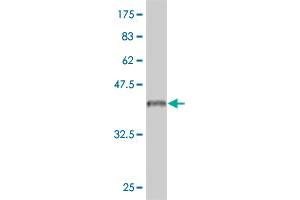 Western Blot detection against Immunogen (37. (IL18RAP antibody  (AA 20-129))