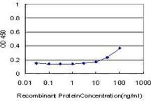 Detection limit for recombinant GST tagged GTF3A is approximately 10ng/ml as a capture antibody. (GTF3A antibody  (AA 185-274))