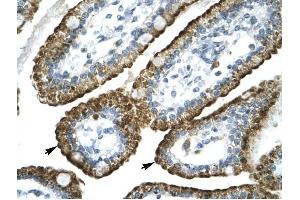 GABRP antibody was used for immunohistochemistry at a concentration of 4-8 ug/ml to stain Epithelial cells of intestinal villus (lndicated with Arrows) in Human Intestine. (GABRP antibody  (N-Term))