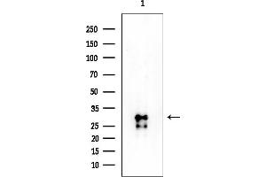 anti-Forkhead Box E3 (FOXE3) (Internal Region) antibody