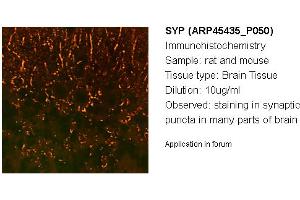 Image no. 2 for anti-Synaptophysin (SYP) (N-Term) antibody (ABIN2782216) (Synaptophysin antibody  (N-Term))