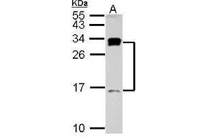 WB Image Sample (30 ug of whole cell lysate) A: Raji 15% SDS PAGE antibody diluted at 1:1000 (C1D antibody)