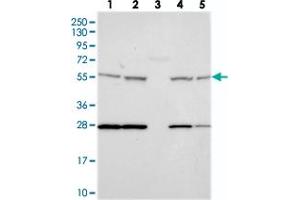 Western blot analysis of Lane 1: RT-4, Lane 2: U-251 MG, Lane 3: Human Plasma, Lane 4: Liver, Lane 5: Tonsil with DDX19A polyclonal antibody  at 1:250-1:500 dilution. (DDX19A antibody)