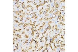 Immunohistochemistry (IHC) image for anti-Chitinase 3-Like 1 (Cartilage Glycoprotein-39) (CHI3L1) (AA 22-240) antibody (ABIN3022445)
