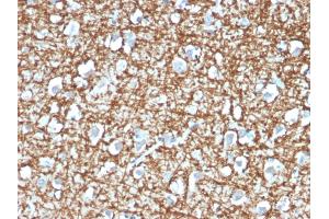 Formalin-fixed, paraffin-embedded human Brain stained with ARF1 Mouse Monoclonal Antibody (ARF1/2117). (ARF1 antibody)