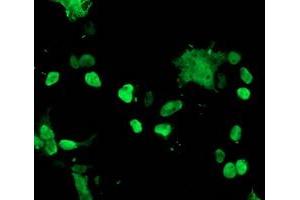 Image no. 3 for anti-T-Cell Acute Lymphocytic Leukemia 1 (TAL1) antibody (ABIN1501291) (TAL1 antibody)