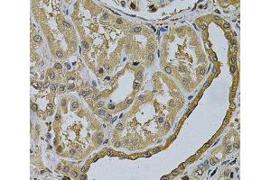 Immunohistochemistry of paraffin-embedded Human kidney using LCP1 Polyclonal Antibody at dilution of 1:100 (40x lens). (LCP1 antibody)