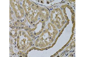 Immunohistochemistry of paraffin-embedded Human kidney using LCP1 Polyclonal Antibody at dilution of 1:100 (40x lens). (LCP1 antibody)