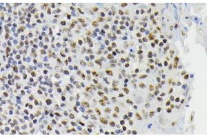 Immunohistochemistry of paraffin-embedded Human tonsil using Phospho-CREB1(S133) Polyclonal Antibody at dilution of 1:200 (40x lens). (CREB1 antibody  (pSer133))