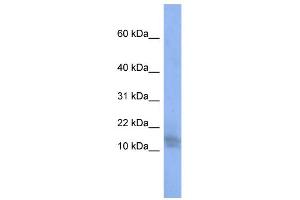 WB Suggested Anti-BRWD1 Antibody Titration:  0. (BRWD1 antibody  (N-Term))