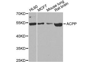 Western blot analysis of extracts of various cell lines, using ACPP antibody. (ACPP antibody)