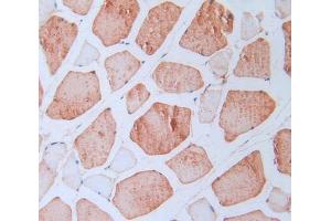 IHC-P analysis of skeletal muscle tissue, with DAB staining.