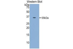Western Blotting (WB) image for anti-Insulin Receptor (INSR) (AA 1024-1298) antibody (ABIN1078206) (Insulin Receptor antibody  (AA 1024-1298))
