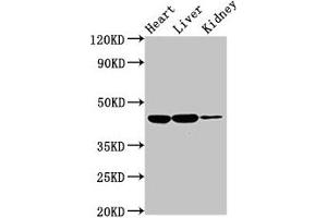Western Blot Positive WB detected in: Rat heart tissue, Rat liver tissue, Rat kidney tissue All lanes: IL10RB antibody at 2 μg/mL Secondary Goat polyclonal to rabbit IgG at 1/50000 dilution Predicted band size: 37 kDa Observed band size: 45 kDa (IL1R2 antibody  (AA 79-219))